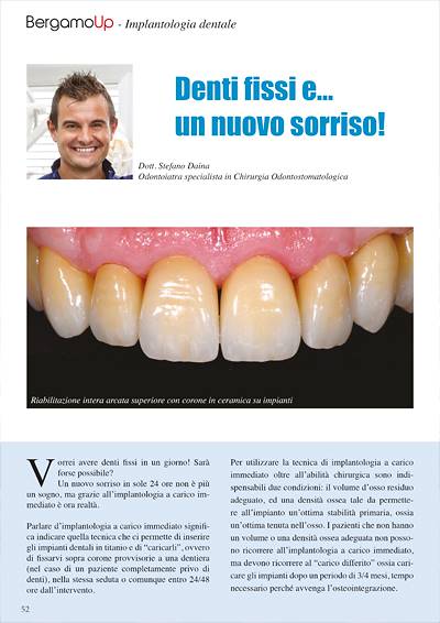 Denti fissi e... un nuovo sorriso!