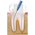 Endodonzia