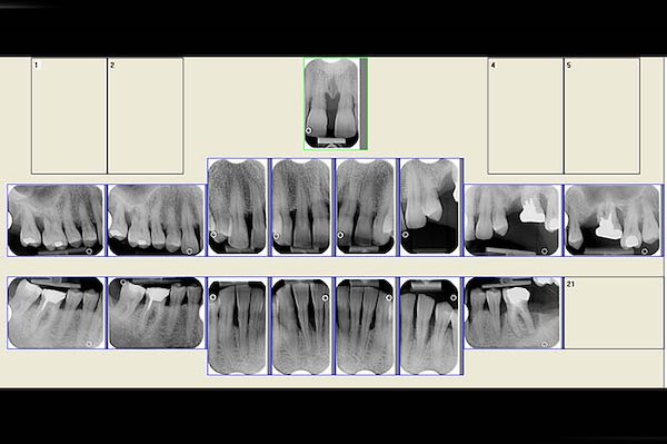 Status radiografico completo