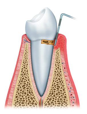 Di che cosa si occupa la parodontologia? 