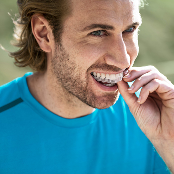 I vantaggi di Invisalign rispetto all'apparecchio tradizionale