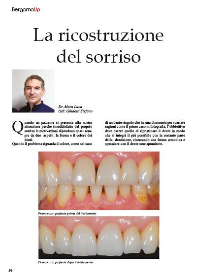 La ricostruzione del sorriso