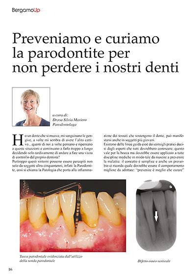 Prevenire e curare la paradontite