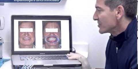 Implantologia a carico immediato
