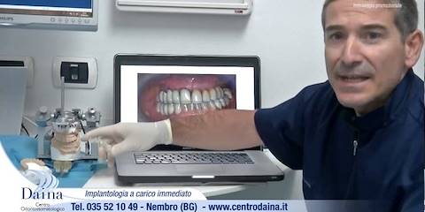 Implantologia a carico immediato