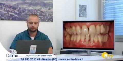 L'importanza della seduta di igiene orale