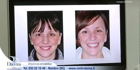 Ortodonzia ed estetica