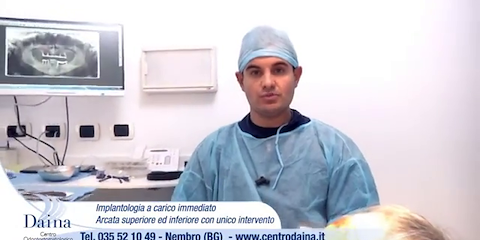 Implantologia a Carico Immediato