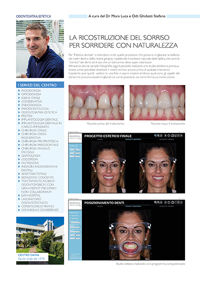 La ricostruzione del sorriso per sorridere con naturalezza _ QuiBg n. 247 Novembre 2017 La ricostruzione del sorriso per sorridere con naturalezza _ QuiBg n. 247 Novembre 2017