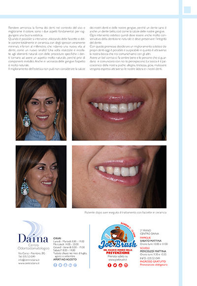La ricostruzione del sorriso per sorridere con naturalezza _ QuiBg n. 247 Novembre 2017 La ricostruzione del sorriso per sorridere con naturalezza _ QuiBg n. 247 Novembre 2017