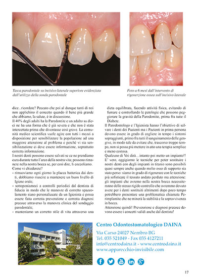 Preveniamo e curiamo la parodontite per non perdere i nostri denti _ n. 67 Aprile 2016 Preveniamo e curiamo la parodontite per non perdere i nostri denti _ n. 67 Aprile 2016
