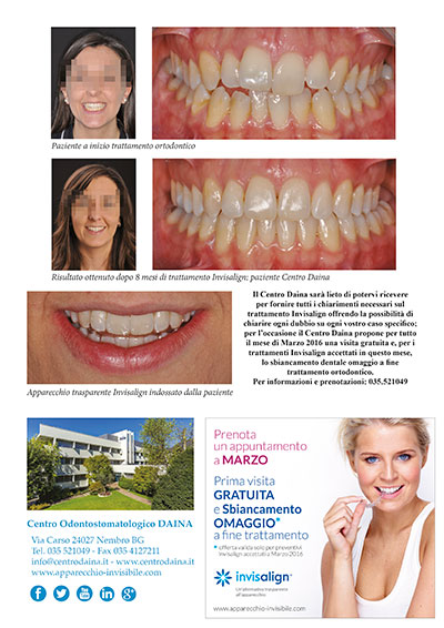 Sorridi di più con Invisalign al Centro Daina _ n. 66 Marzo 2016 Sorridi di più con Invisalign al Centro Daina _ n. 66 Marzo 2016