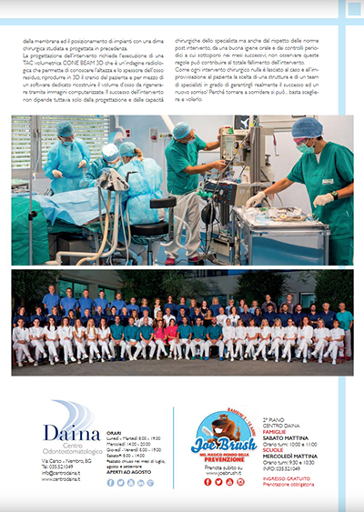 Rigenerativa ossea per avere denti fissi su impianti _ QuiBg n. 242 Maggio 2017 Rigenerativa ossea per avere denti fissi su impianti _ QuiBg n. 242 Maggio 2017