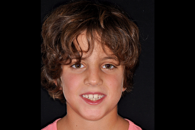 img_casi